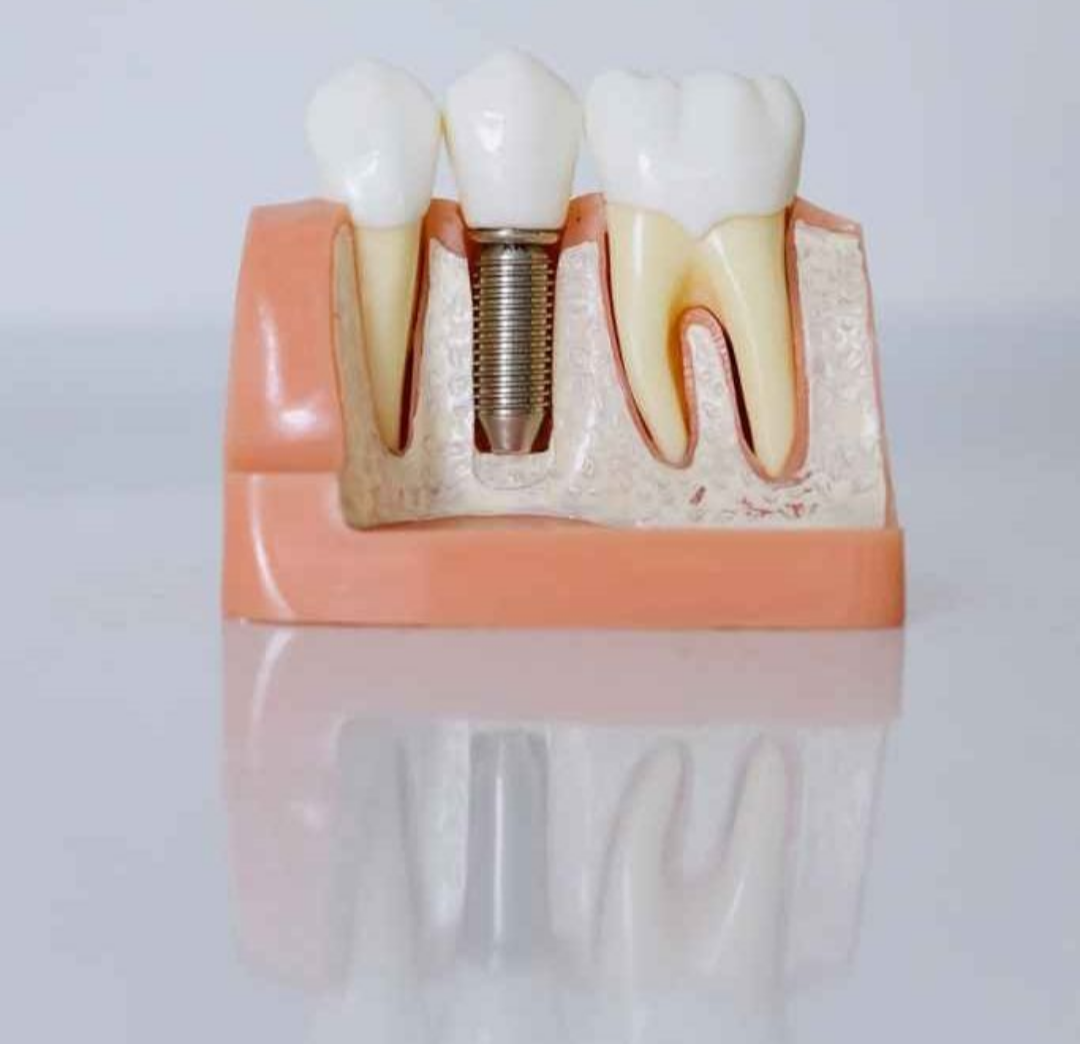 Do “starchy carbohydrates” worsen dental health?